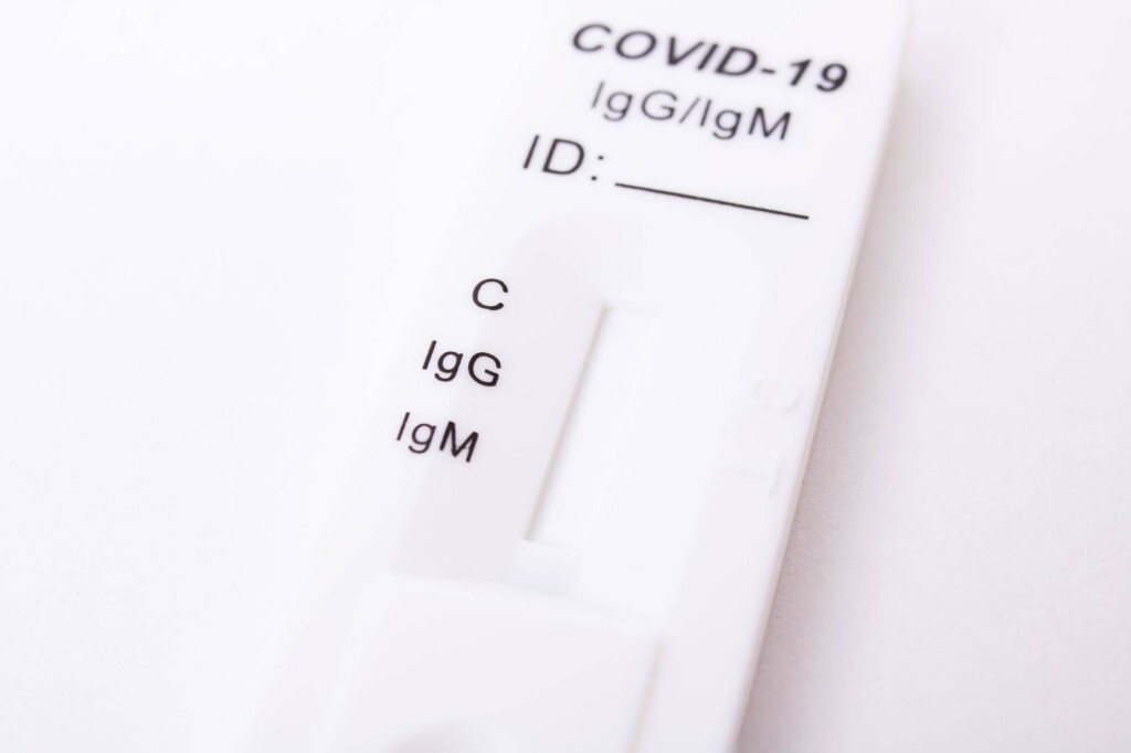 Jak szybko test wykrywa covid podczas infekcji?