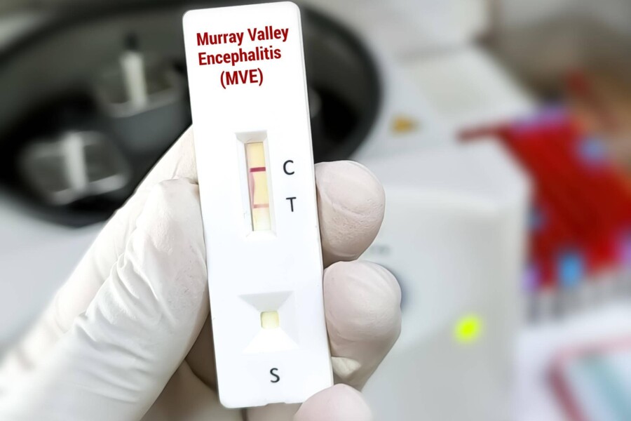 Kiedy test na HIV jest wiarygodny?