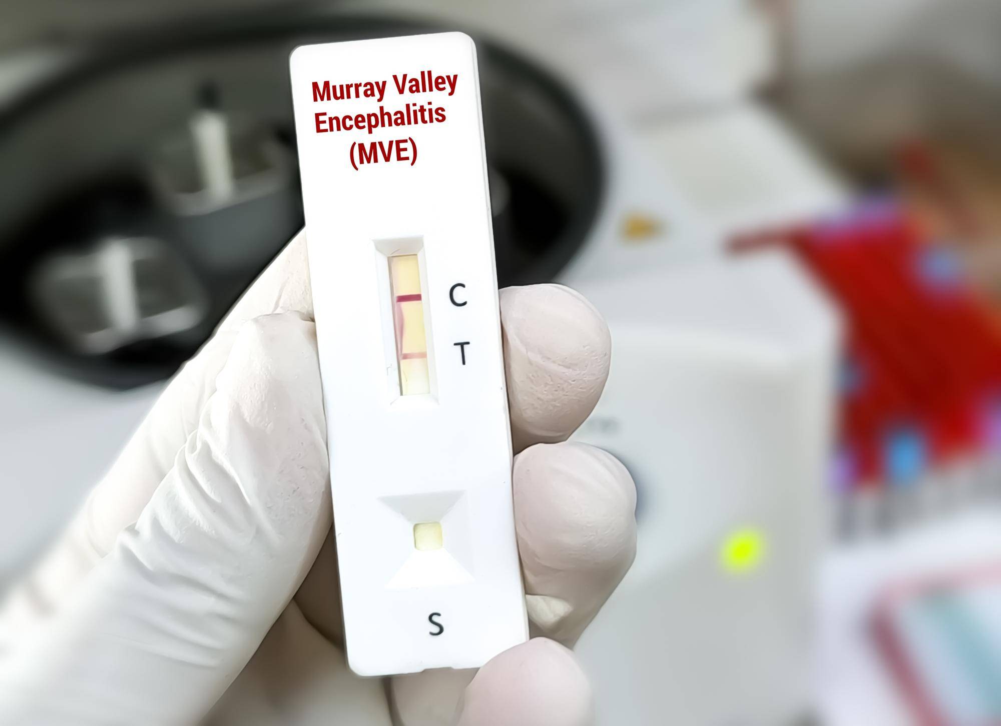 Kiedy test na HIV jest wiarygodny?