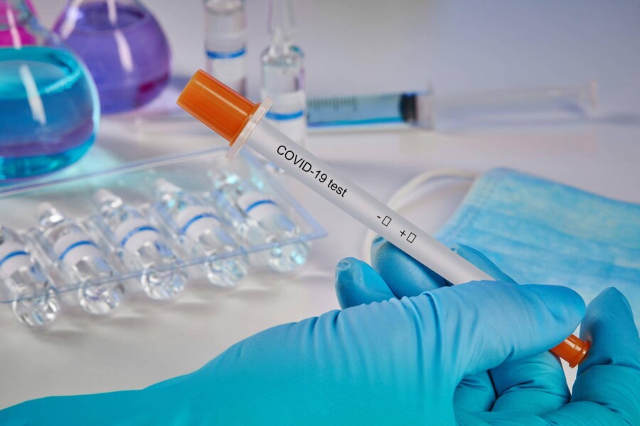 Jak się przygotować do testu PCR przed wizytą w punkcie diagnostycznym