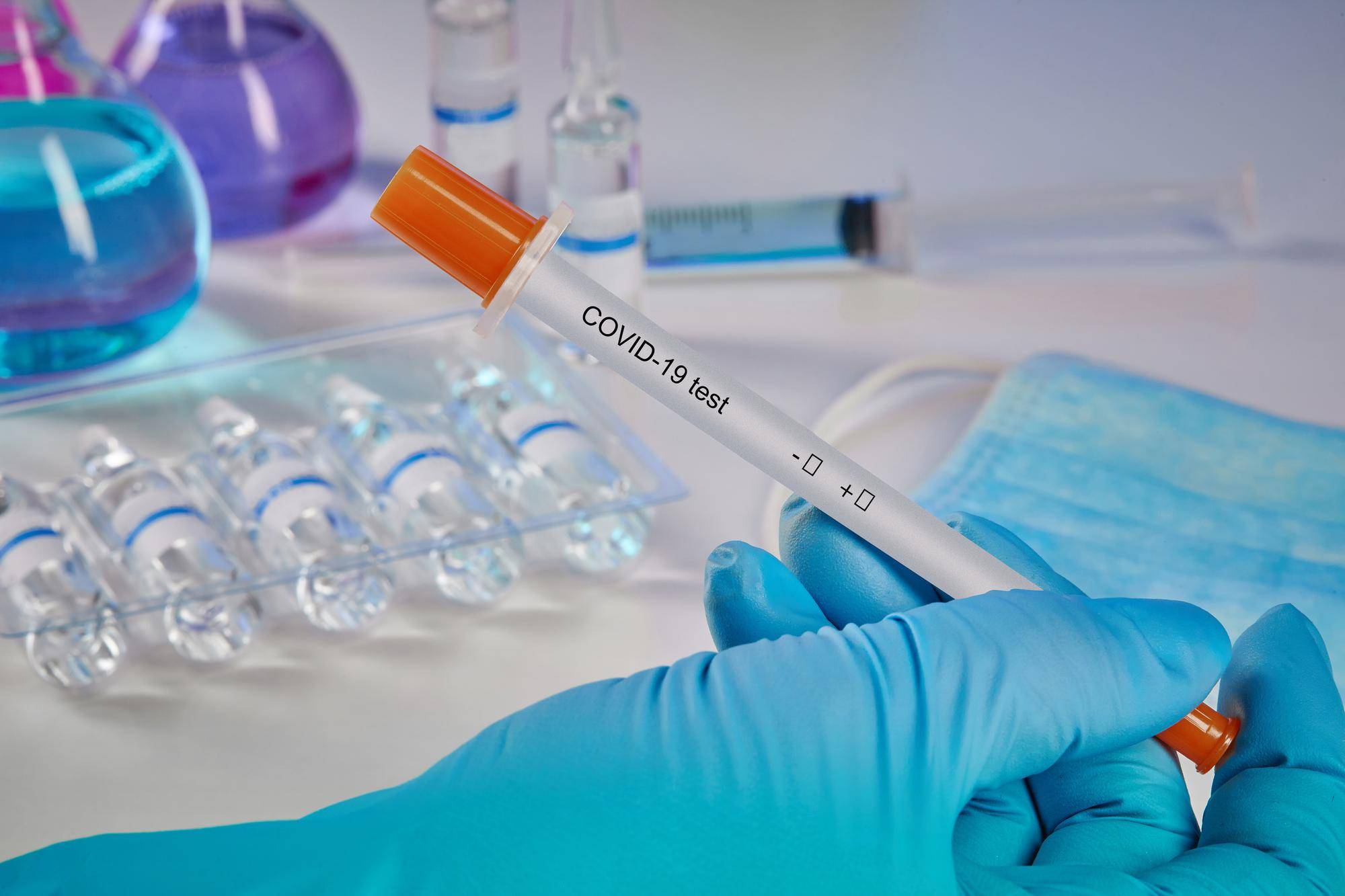 Jak się przygotować do testu PCR przed wizytą w punkcie diagnostycznym